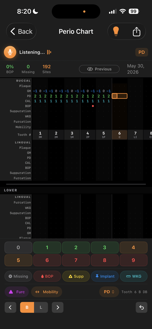 The PerioMaxer periodontal chart on a phone, listening for spoken values
